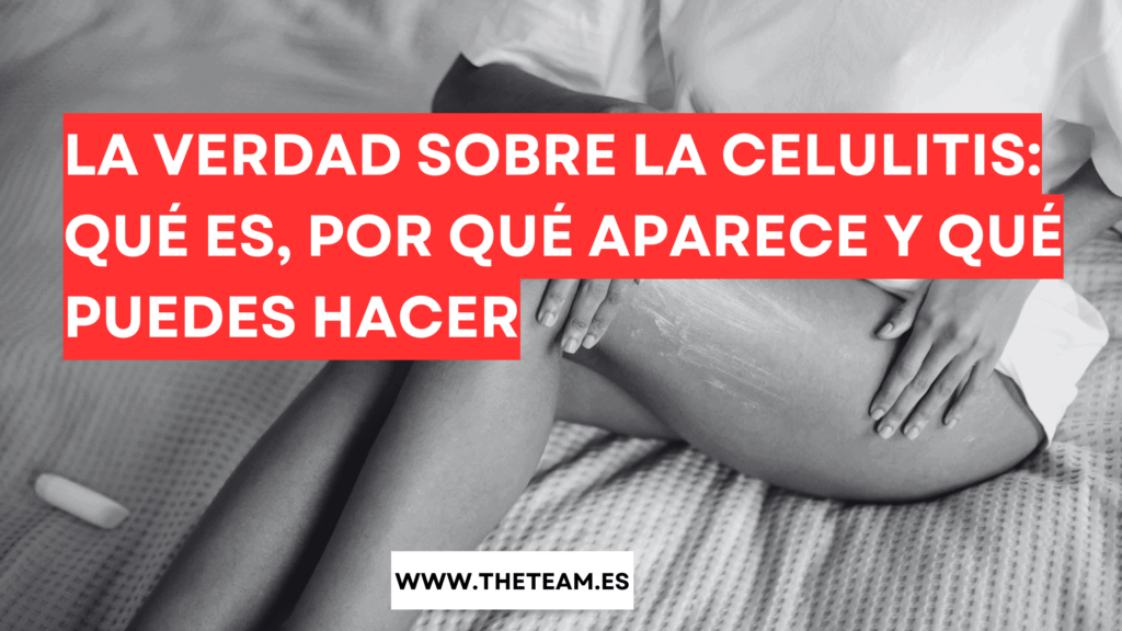 La verdad sobre la celulitis: qué es, por qué aparece y qué puedes hacer